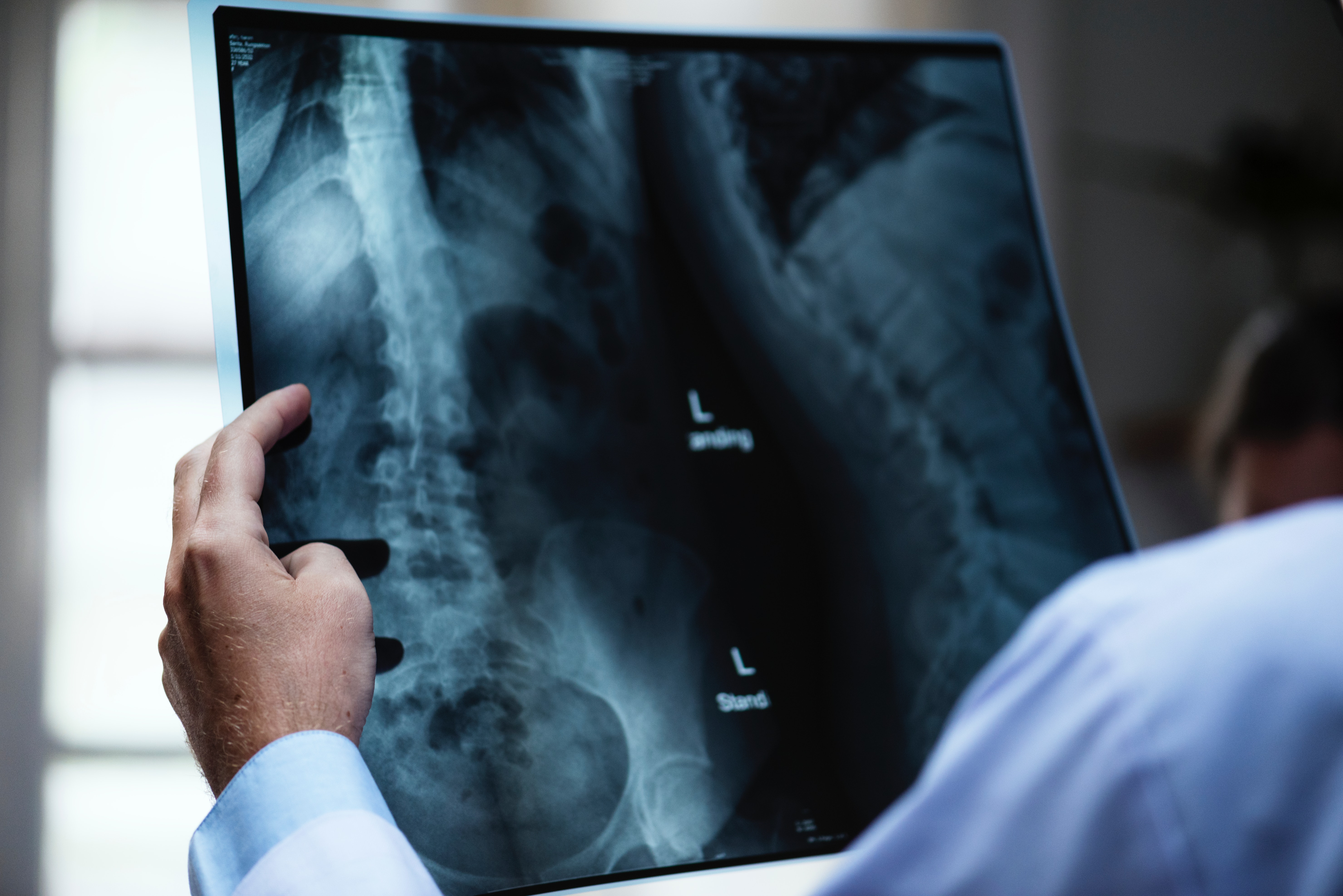 How Spine Injury Victims Can Get Legal Help